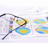 השתלת קרנית מלאה - תמונת המחשה